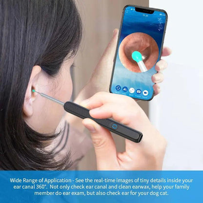 Smart Visual Ear Cleaner